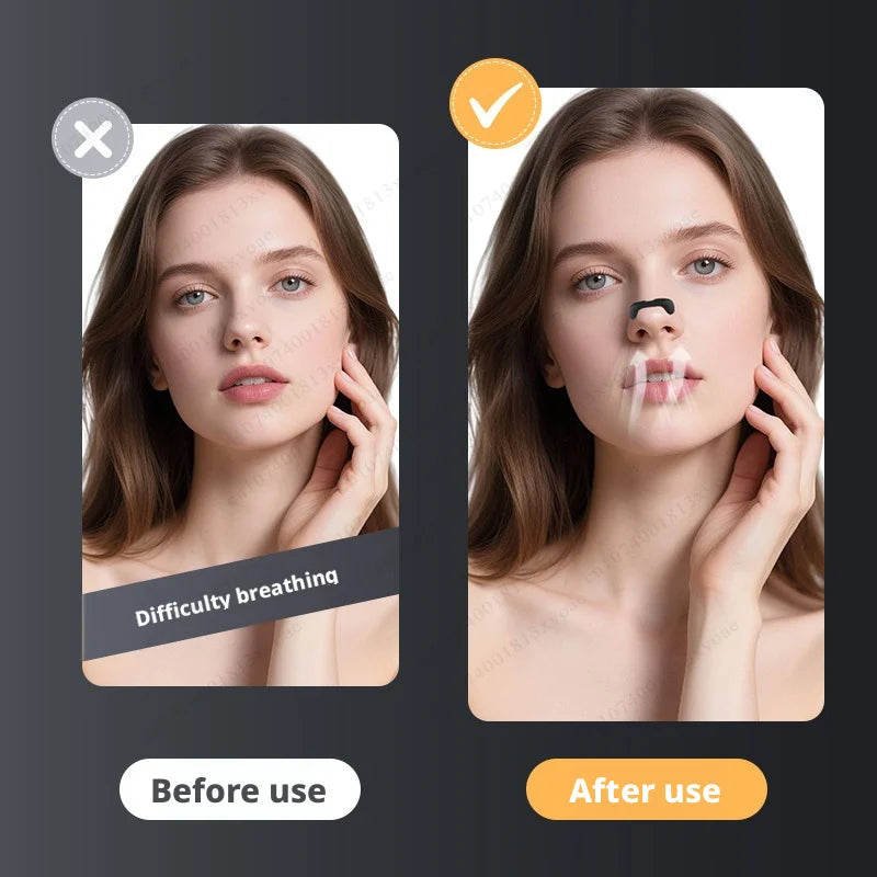 Nasal Dilator Sleep Nasal